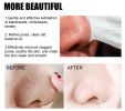 Blackhead, and Acne Removal Nasal Mask, Deep Pore Cleansing