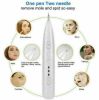 Ion Laser Pen To Remove Freckles, Moles, Dark Spots, Warts, Tags, and Tattoos